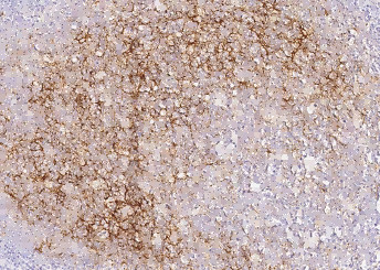 Anti-CD14 Monoclonal Antibody