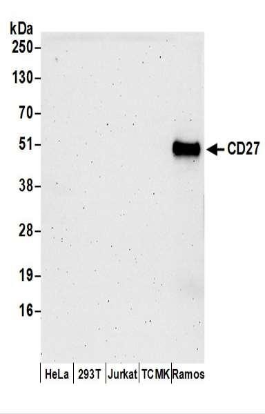 Anti-CD27