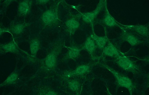 Anti-phospho-Akt1 (Ser473), clone X20-A