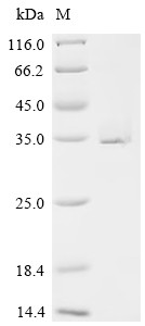 Ras-related protein Rab-6A (RAB6A), human, recombinant