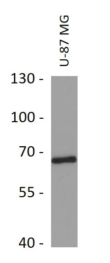 Anti-CDK5RAP3