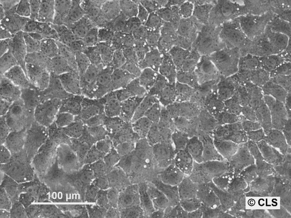 Hep-70.4 Cells