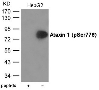 Anti-Phospho-ATXN1 (Ser776)