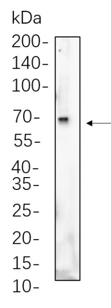 Anti-Recombinant Albumin, clone 5B14