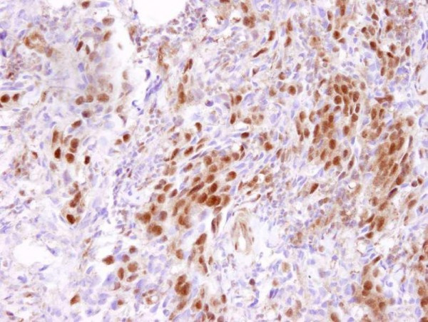 Anti-CARM1 (IHC)