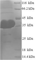 Protein argonaute-2 (AGO2), partial, human, recombinant