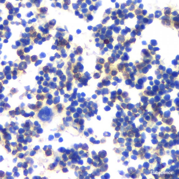 Anti-MMP13