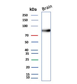 Anti-CD105 / Endoglin, clone r4G11