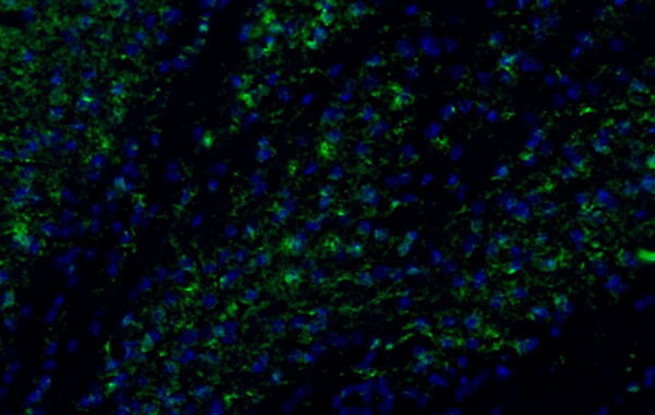Anti-MCP-1 / CCL2