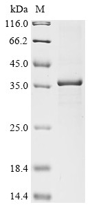 17-beta-Hydroxysteroid dehydrogenase 13 (Hsd17b13), rat, recombinant