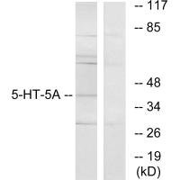Anti-HTR5A