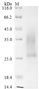 Collagen triple helix repeat-containing protein 1 (Cthrc1), mouse, recombinant