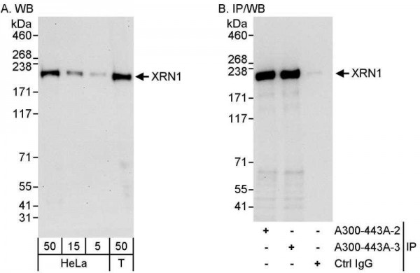 Anti-XRN1