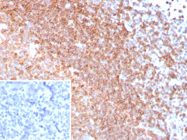 Anti-CXCR5 (Marker of T Follicular Helper (Tfh) Cells), recombinant antibody, clone CXCR5/8279R