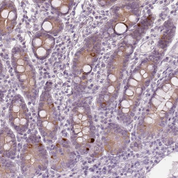 Anti-PRAP1