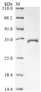 Estradiol 17-beta-dehydrogenase 11 (HSD17B11), human, recombinant