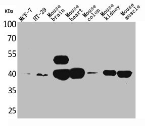 Anti-IDH3A