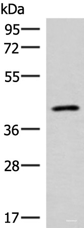 Anti-SLC16A7