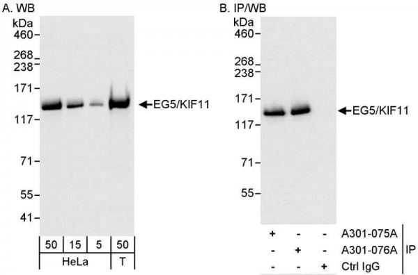 Anti-EG5/KIF11