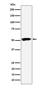 Anti-PPP2R5E / Serine/threonine-protein phosphatase 2A regulatory subunit B epsilon, clone 30P55