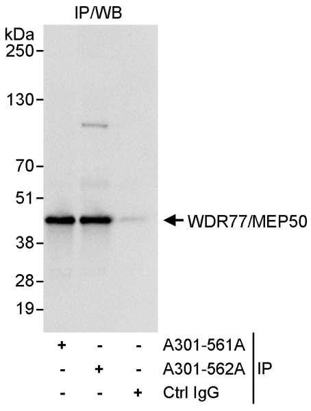 Anti-WDR77/MEP50