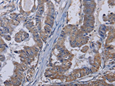 Anti-TRPM8