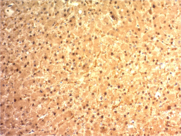 Anti-Arginase1 (Hepatocellular Carcinoma Marker), clone ARG1/1125