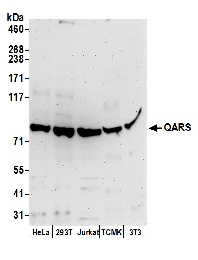 Anti-QARS