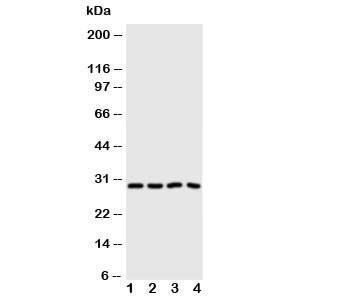 Anti-Carbonic Anhydrase III antibody