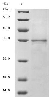 Tumor necrosis factor-inducible gene 6 protein (TNFAIP6), human, recombinant
