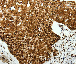 Anti-SCN11A