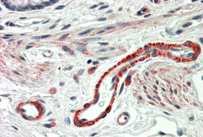 Anti-THBS3, C-terminal