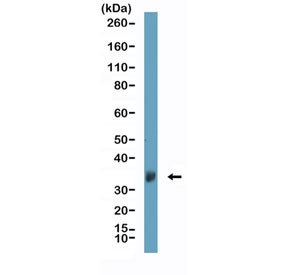 Anti-Clusterin / Apolipoprotein J (recombinant antibody), clone RM437