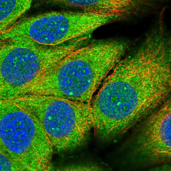Anti-PAFAH1B2