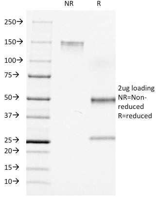 Anti-CD7 (T-Cell Leukemia Marker), clone C7/511