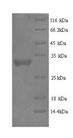 Protein delta homolog 2 (DLK2), partial, human, recombinant