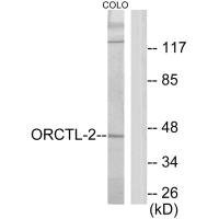 Anti-SLC22A18