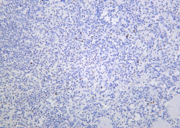 Anti-Recombinant Histone H4 (Acetyl Lys16), clone 11A6