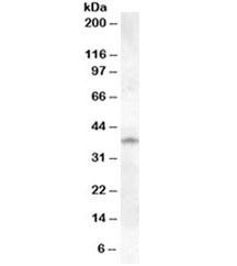 Anti-Cathepsin K