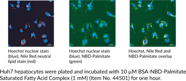 BSA-NBD-Palmitate Saturated Fatty Acid Complex (1 mM)