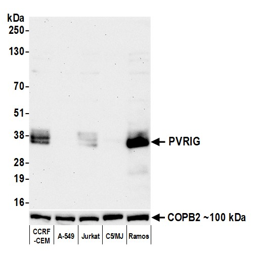 Anti-PVRIG Recombinant Monoclonal