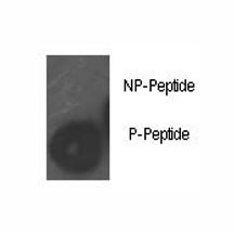 Anti-phospho-Rb (Ser780)