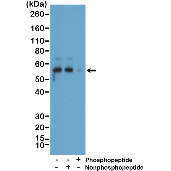 Anti-phospho-Tau (Ser396), Rabbit Monoclonal (RM461)