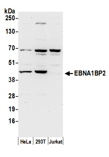 Anti-EBNA1BP2/EBNA1 Binding Protein 2/EBP2