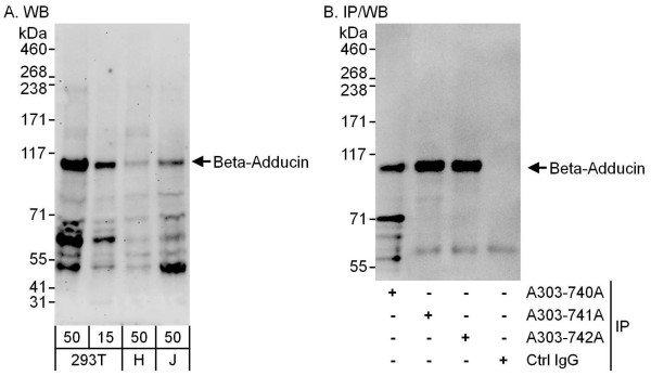 Anti-Beta-Adducin