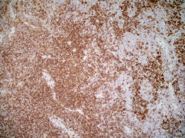 Anti-CD4, clone OX-35