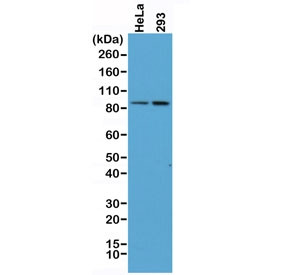 Anti-Beta Catenin / CTNNB1, clone RM276 (recombinant antibody)