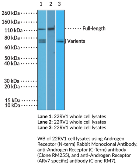 Anti-Androgen Receptor (N-Term) Rabbit Monoclonal Antibody (Clone RM254)