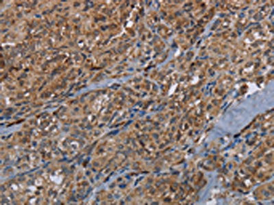 Anti-HMGCR