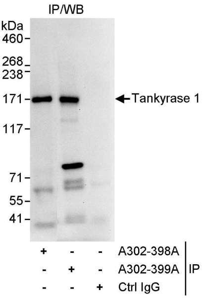 Anti-Tankyrase 1